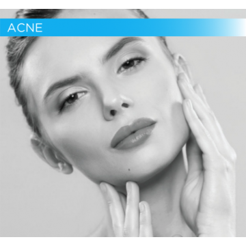 ACNE - Уход за жирной, комбинированной и склонной к АКНЕ коже - MAD Skincare